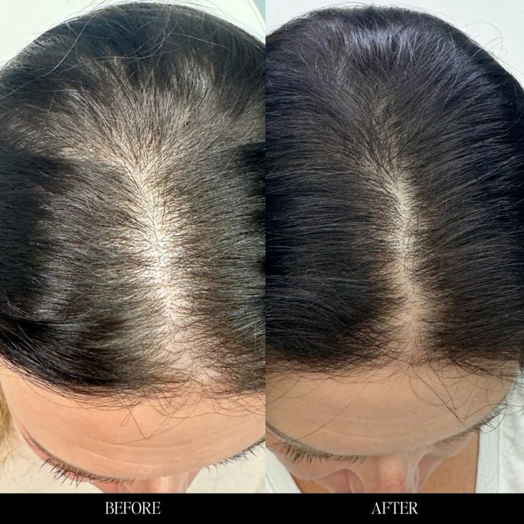 Hair Growth Oil